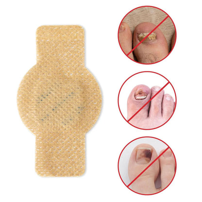 Fungal Nail Patches