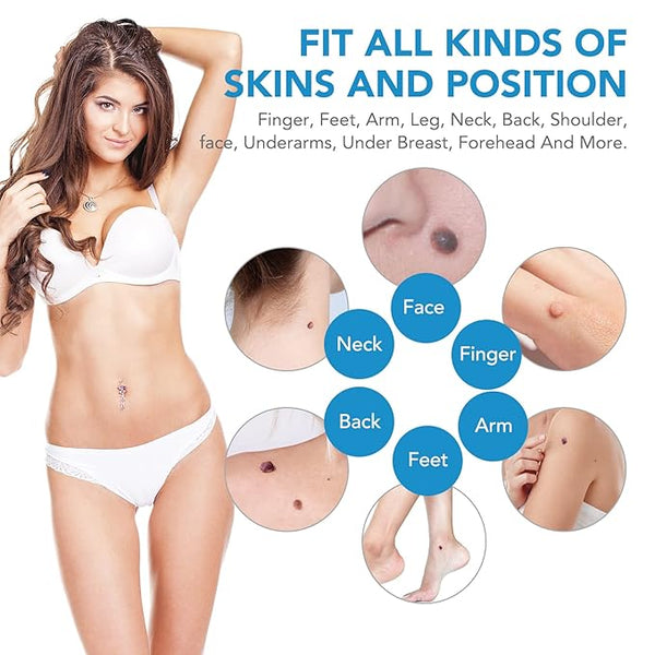 Skin Tag Remover Kit with 40 Bands