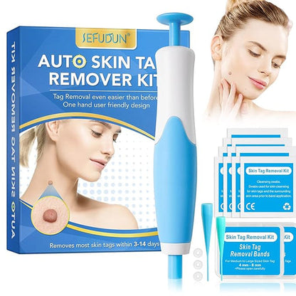 Skin Tag Remover Kit with 40 Bands